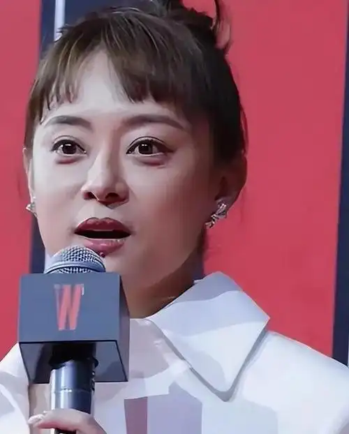 孙俪突然变美,眼睛不凸也不胖脸了,下巴的痣引热议!被疑整容!