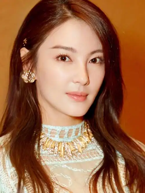 人间鹦鹉张雨绮告诉你双眼皮有多重要