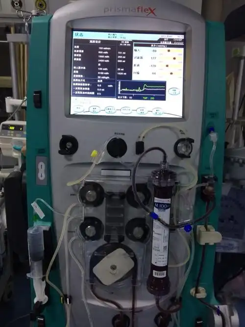血滤机正常运转中