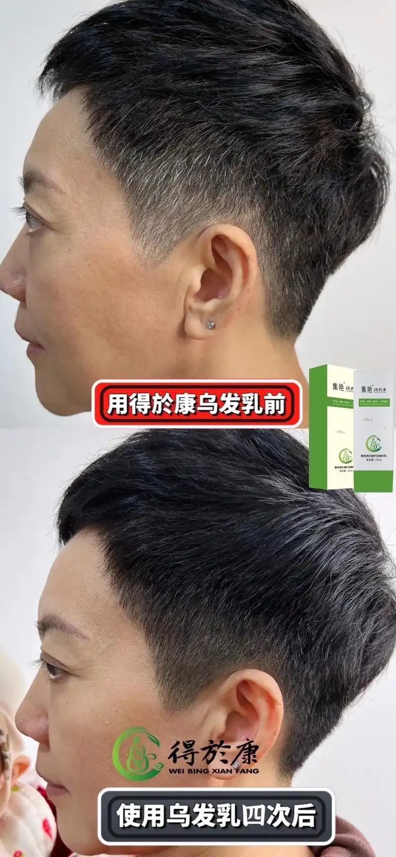 98996903霞姐第四次用乌发乳的效果.9899