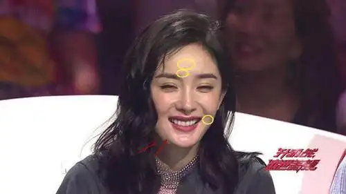 头发油腻脸上长痘笑起来嘴非常瘪杨幂怎么越来越丑了