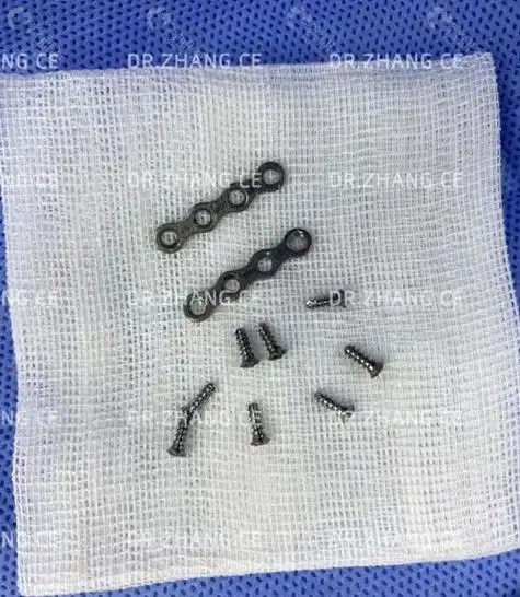 3d打印鼻基底手术使用的钛钉