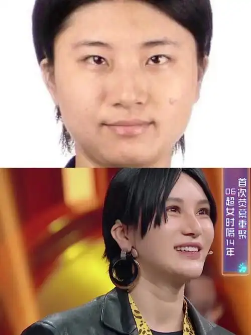 尚雯婕整容真的是让人无法直视_圈子-新氧美容整形