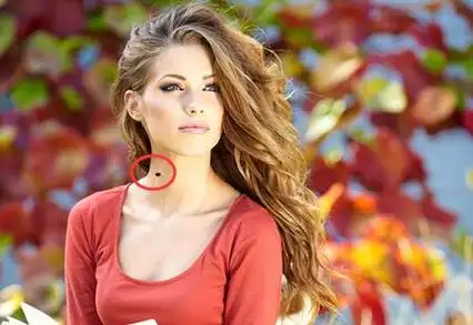 脖子上长痣是好事还是坏事注意痣的位置