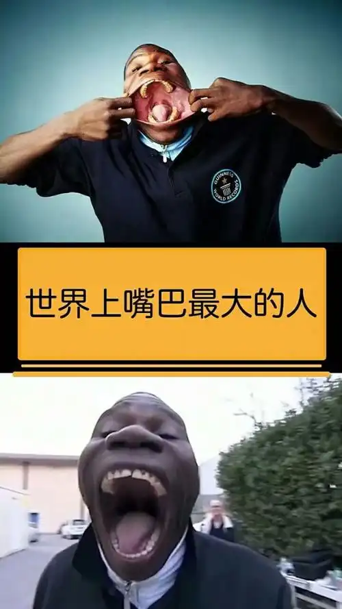 世界上嘴巴最大的人