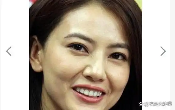 秃头眼凸,松弛显老,从孙俪到陶虹,无效养生反噬的女星真不少!