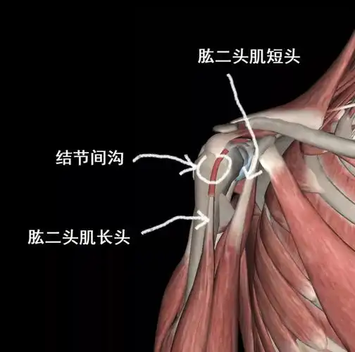 针刺肱二头肌长头肌腱炎的绝招