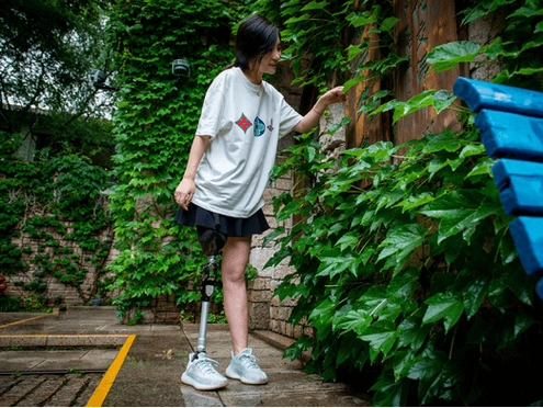 假肢的使用优势有哪些——精博康复