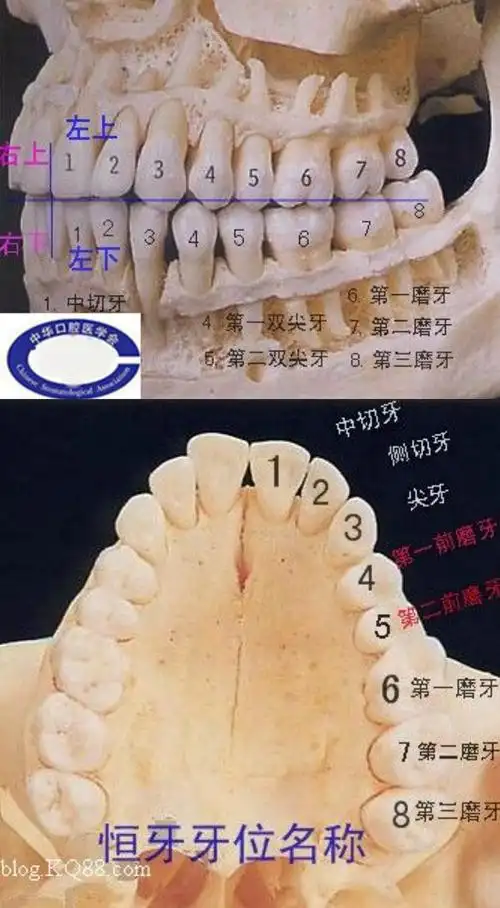 牙齿位置十字图本人共7缺失颗牙,或需种牙,位置分别是:上颌:右侧4,5,6