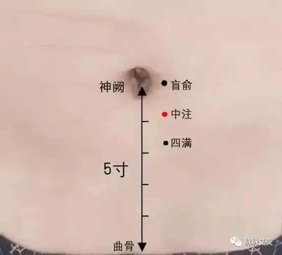 阴囊湿疹主灸这里附药物治疗方法