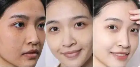 其实选择淡斑效果好的护肤品,可以让黑色素更快的消失!