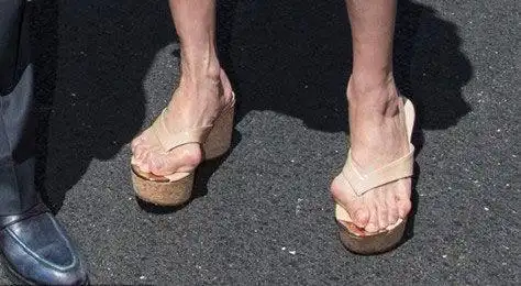 娱乐圈女明星的脚!宋茜畸形长茧,杨丞琳戴矫正器,金星最吓人