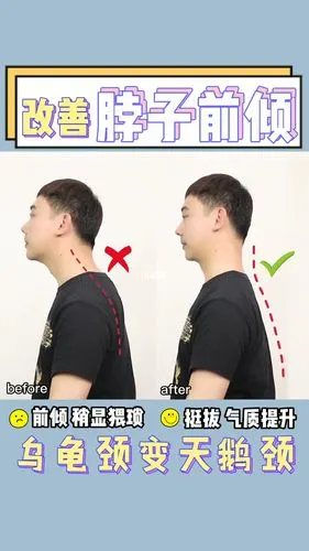 改善脖子前倾乌龟颈变天鹅颈