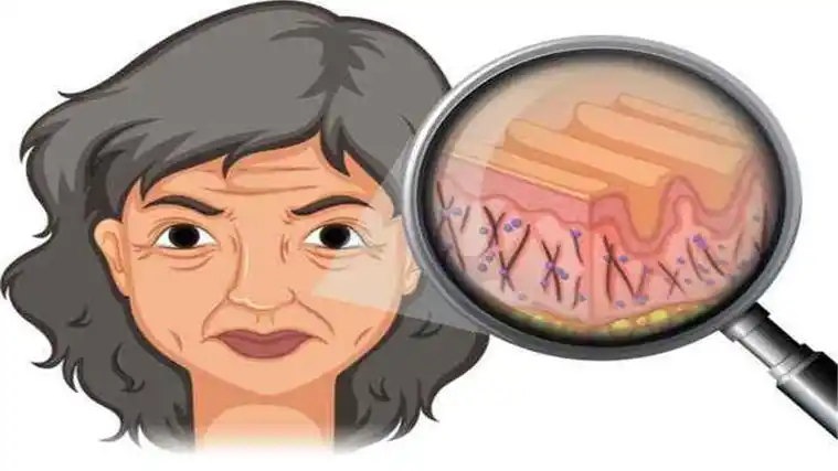 脸上皮肤松弛怎么办