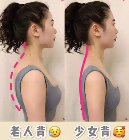 孩子弯腰驼背应该怎么矫正医生建议这样做