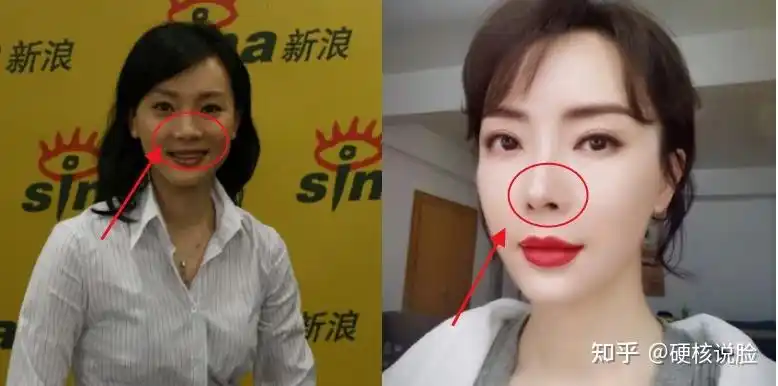 娱乐圈扒皮系列——第十二期,陈数整容史(整容最成功的明星)