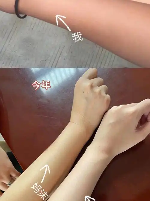 震惊,从去年开始家里人一直说我变白了变白了,但我自己都没有什么感觉