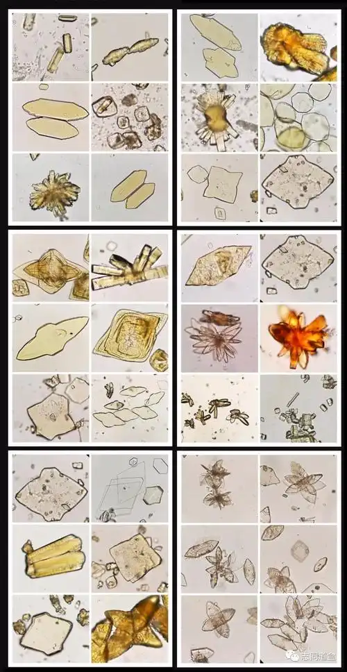 百变黄金叶尿酸结晶