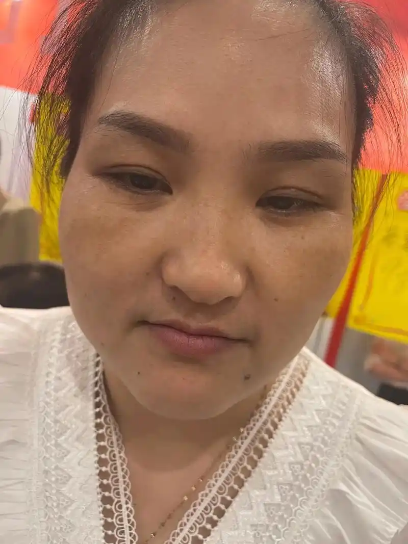 首次公开素颜苹果原相机照片,岁月痕迹,得了一种脸上有斑的丑 - 抖音