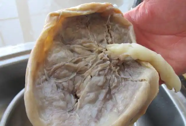 生完宝宝后"胎盘"该怎么处理?产科医生给了建议,产妇要知道