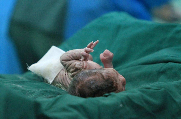 第一胎孩子打掉的后果:女人第一胎打掉有什么影响