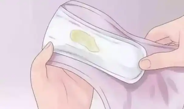 女性内裤上黄黄的分泌物是什么