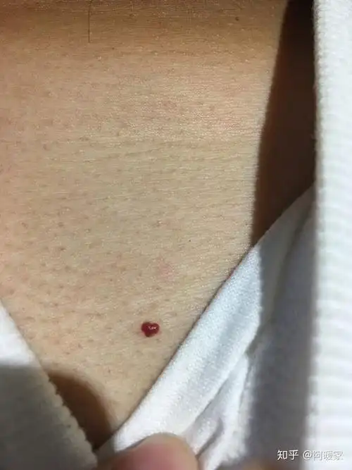 如果你男友心头有另一颗朱砂痣,你会介意吗?