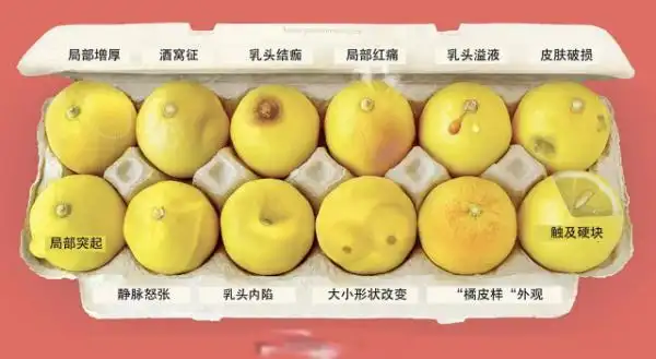 乳腺癌成全球最常见癌症男性也要小心无法预防该咋办