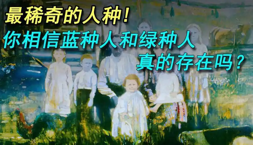 蓝种人百年难得一见,绿种人或许可以光合作用!