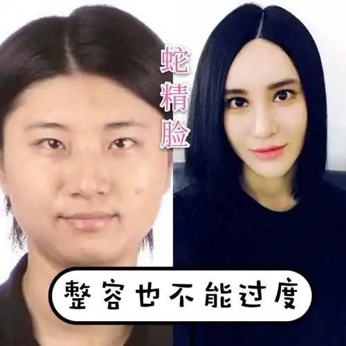 尚雯婕"变脸史"是怎么变成"蛇精脸"的现在的尚雯婕_圈子-新氧美容整形