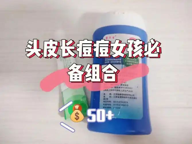 头上长痘痘,有这两样就够了75亲测有效93