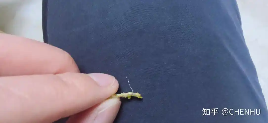 始于2022.1.28止于2022.2.20从手术开始到结束历时23天,非常满意.