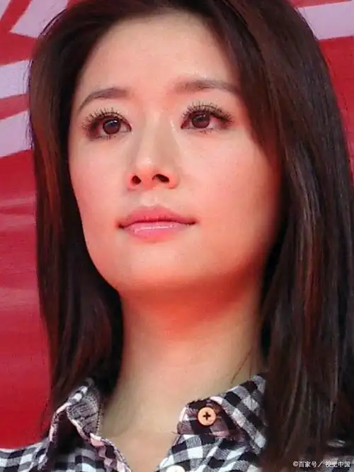 林心如鼻子怪异被质疑整容