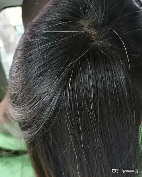 有没有人有过白发变黑的经历,是用什么办法变黑的呢?