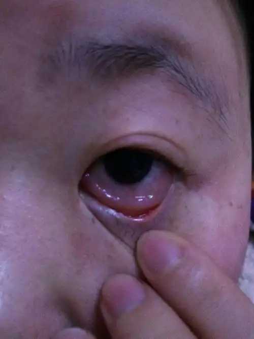 就是刚才才有的,眼睛前段时间就特