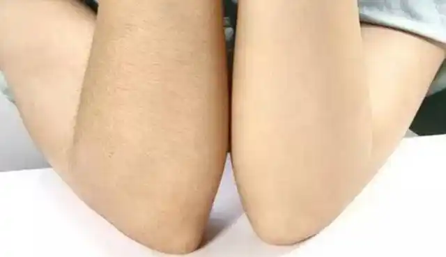 为什么有的女性体毛旺盛有的却光秃秃女性不妨来了解一下