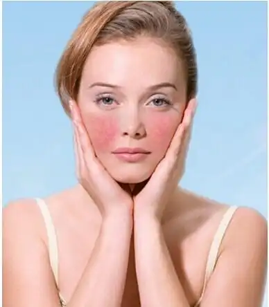 【丹植化妆品】分享敏感肌的护肤心得