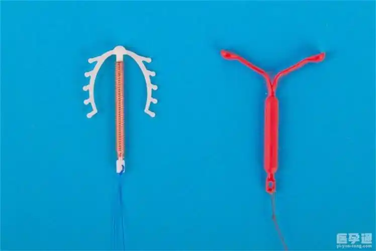 节育环有哪几种图片分享十年危害难以想象