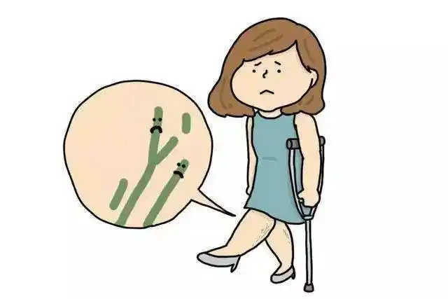 静脉曲张治疗不及时存截肢风险 |健康课堂_手机搜狐网