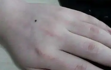 手背长痣的女人可要抓紧了!