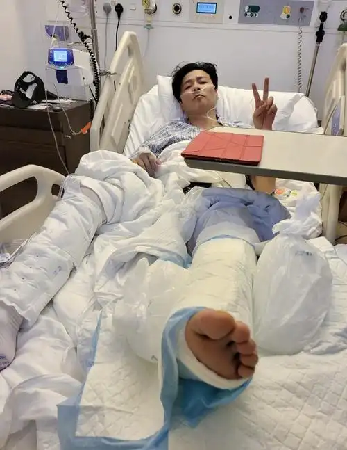 张晋拍戏受重伤住院,住豪华病房疑腿摔骨折,面相憔悴乃乐观!