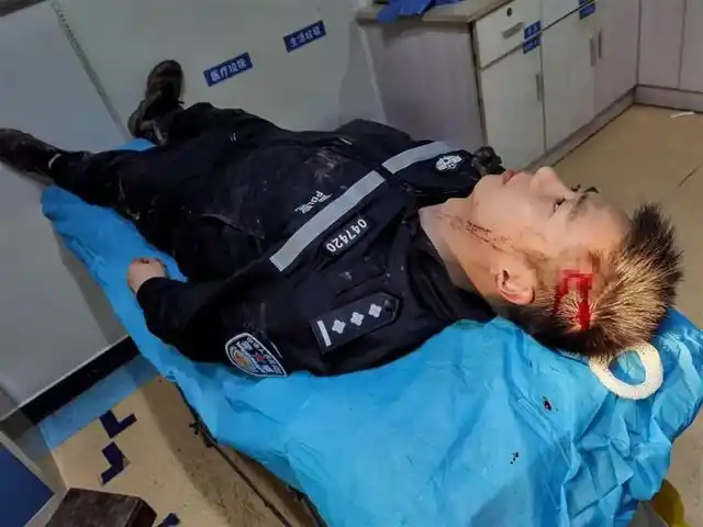 严思遥头部受伤