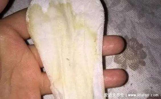 早期宫颈癌内裤症状图片,内裤上总有血迹/分泌物异常伴随恶臭