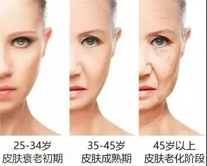 二,健康因素:身体底子差的人皮肤更容易老化.