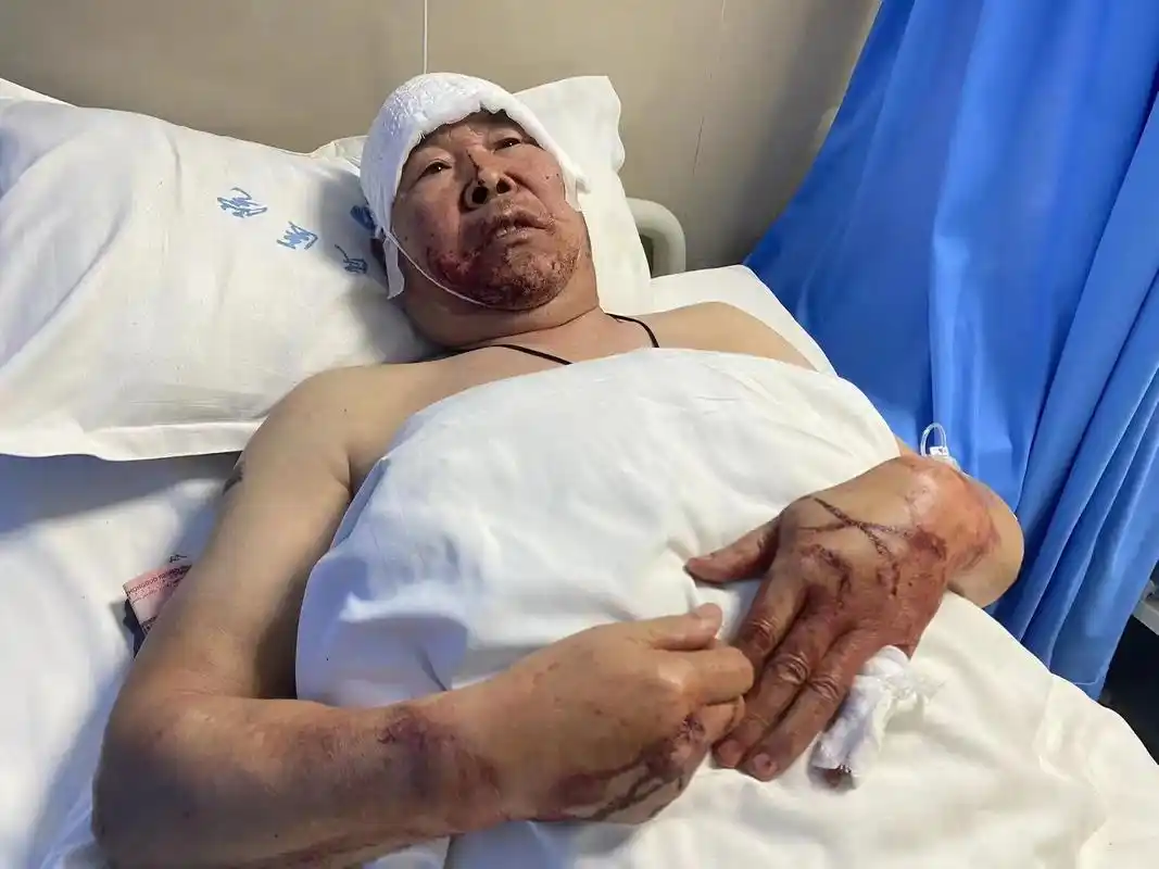 老爸还是一身正气,在遇到租户被砍伤两人后慌忙求救,歹徒持刀紧 - 抖