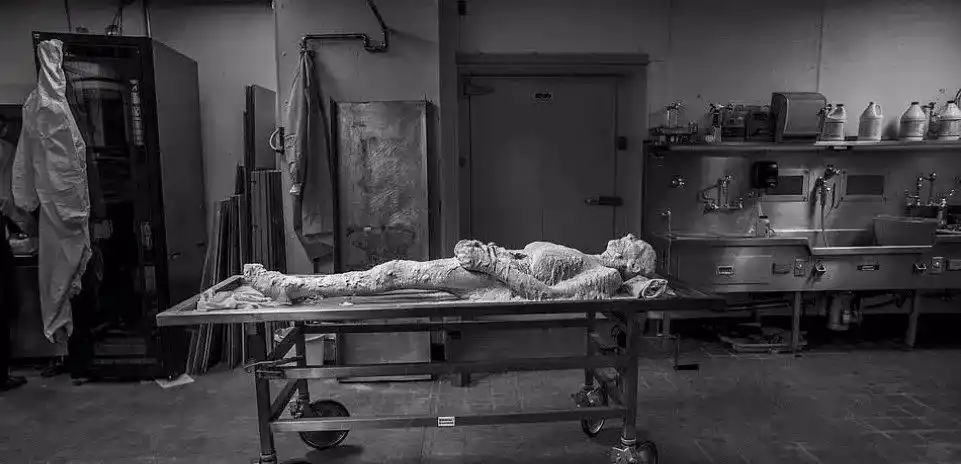 解剖课看到朋友尸体医学院学生恩雅·埃格比被解剖课上的尸体惊吓到