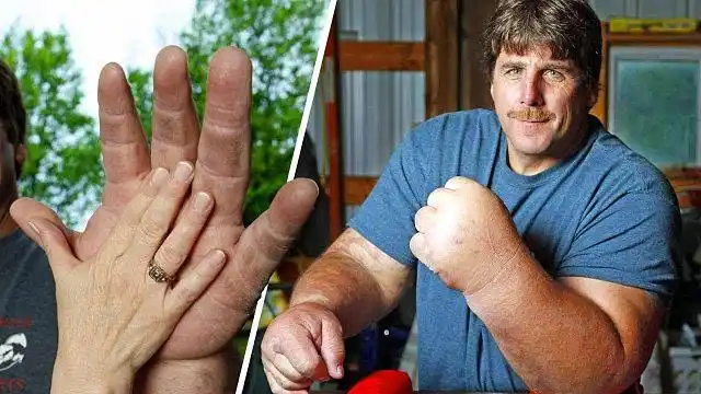 人类最大的手掌能长到多大?看到这男子我惊了!