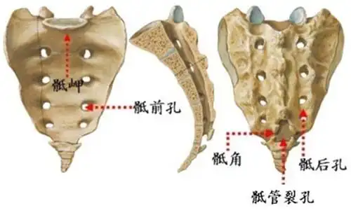 骶管封闭注射治疗腰腿痛
