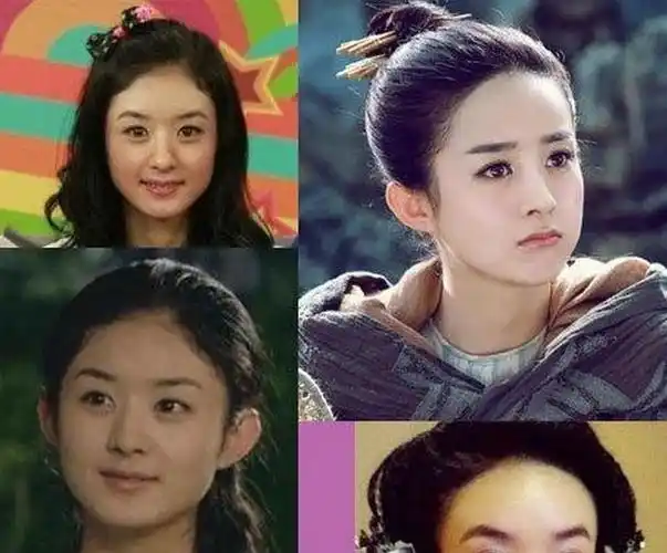 赵丽颖是整了发际线颜值变高是怎么回事