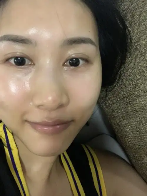 你的素颜真实皮肤状态是什么样子呢?